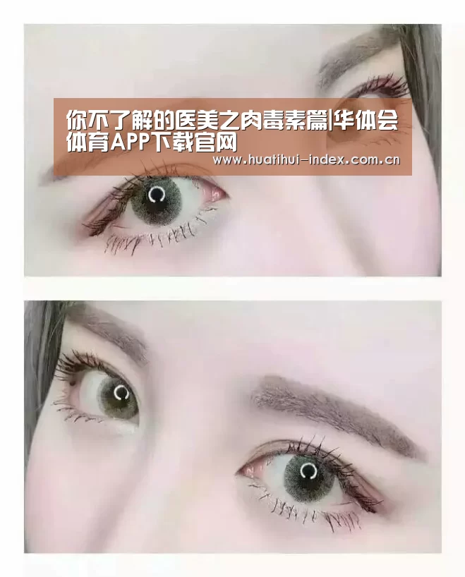 你不了解的医美之肉毒素篇|华体会体育APP下载官网(图1) 华体会棋牌